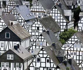 脸上浮肿是什么原因（睡太多脸上浮肿是什么原因）